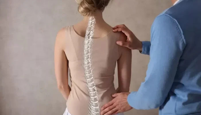 Apakah Chiropractic Bisa Menyembuhkan Skoliosis? Cek Faktanya